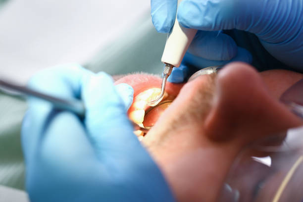 Best Emergency Dental Care for Broken or Chipped Teeth in Hurlburt Field, FL