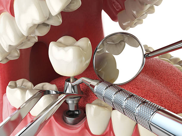 Best Weekend Emergency Dentist in Hurlburt Field, FL
